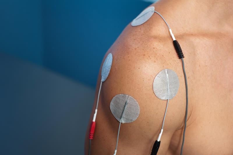 Electrical Stimulation 